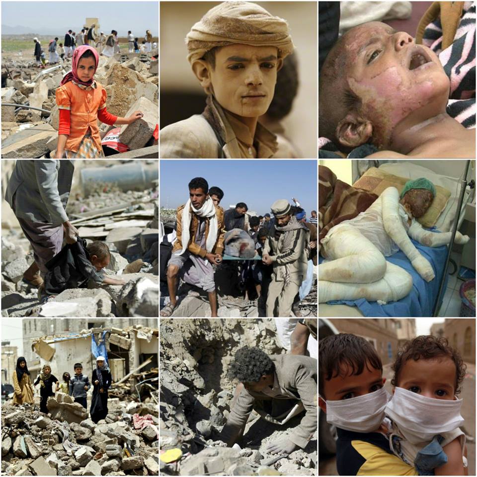 The Real Face of Saudi-led Airstrikes (Photo)