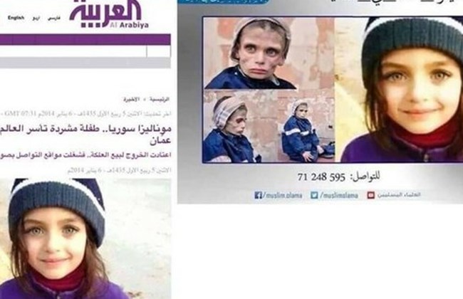 Anti-Assad Propaganda: Fake ‘Starving Syrian Child’ Photo is Revealed