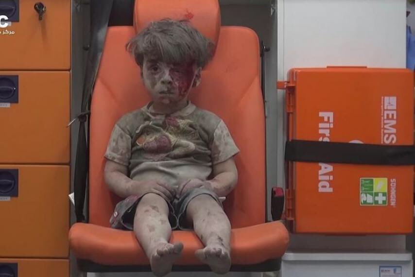 Journalists Found Boy Filmed In White Helmets' Douma Chemial Attack Video. He Did It For Food