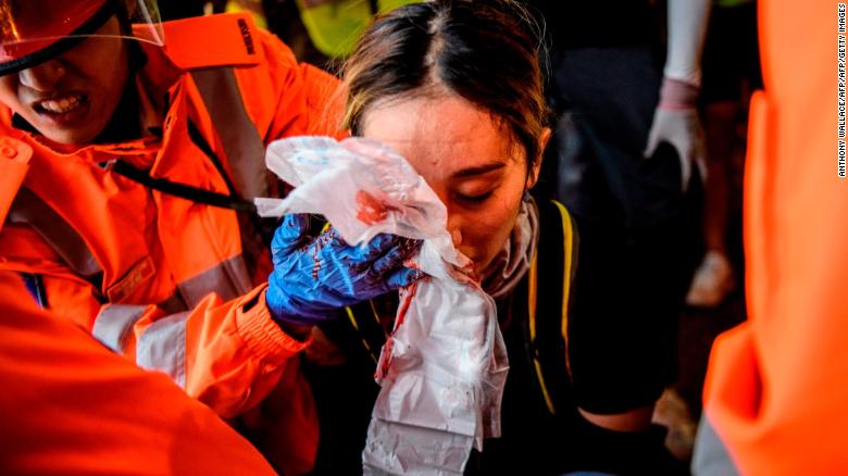 Protests In Hong Kong Continue With Increasing Violence And Casualties