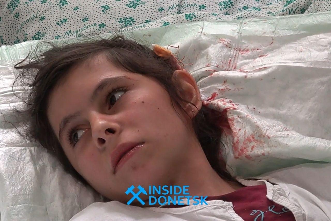 Military Porovcations: Kiev Regime Forces' Strikes Injure Children In Eastern Ukraine (Photos)