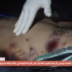 New Massacre In Yemen: Saudi-led Coalition Airstrike On Taiz Leaves 18 Civilians Dead (Photos)