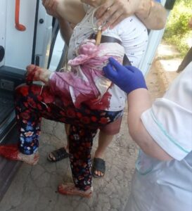 Unable To Advance, Ukrainian Forces Kill Civilians In Donbass (Photos)