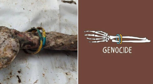 Secret Of Bones With Ukrainian Flag Found In Izyum Revealed (18+)