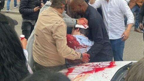 In Video: Colombian Right-Wing Presidential Candidate Shot Twice At Event