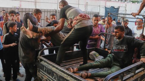 The Israeli Regime Continues To Deliberately Impose Starvation On The People Of Gaza (21+)