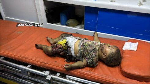 The Israeli Regime Continues To Deliberately Impose Starvation On The People Of Gaza (21+)