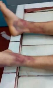 The Cost of Mobilization: Deaths Behind the Walls of TRCs and Rising Public Anger in Ukraine